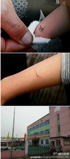 上海剪伤7名孩子手腕幼师被拘10天罚款500元（组图）
