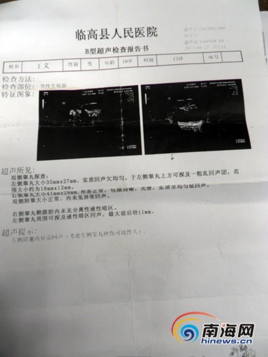 海南临高男子称被警方审讯殴打 致睾丸坏死（组图）