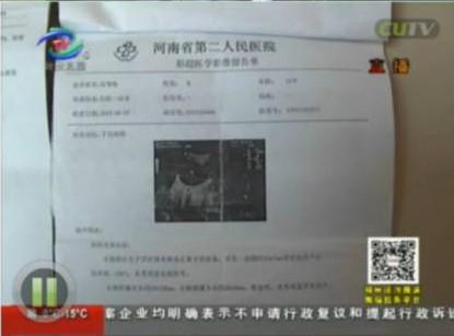 郑州10岁女孩做阑尾手术被切除子宫 院方称手术很成功（视频/组图）