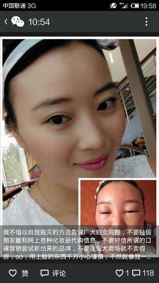 北京一女白领用LV旗下馥蕾诗保湿面膜 脸肿成猪头（组图）